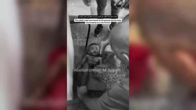 Gazze’de korkunç manzara! Bacakları toprak altında, bedeni ağaç dalında asılı halde bulundu Gazze’de korkunç manzara! Bacakları toprak altında, bedeni ağaç dalında asılı halde bulundu