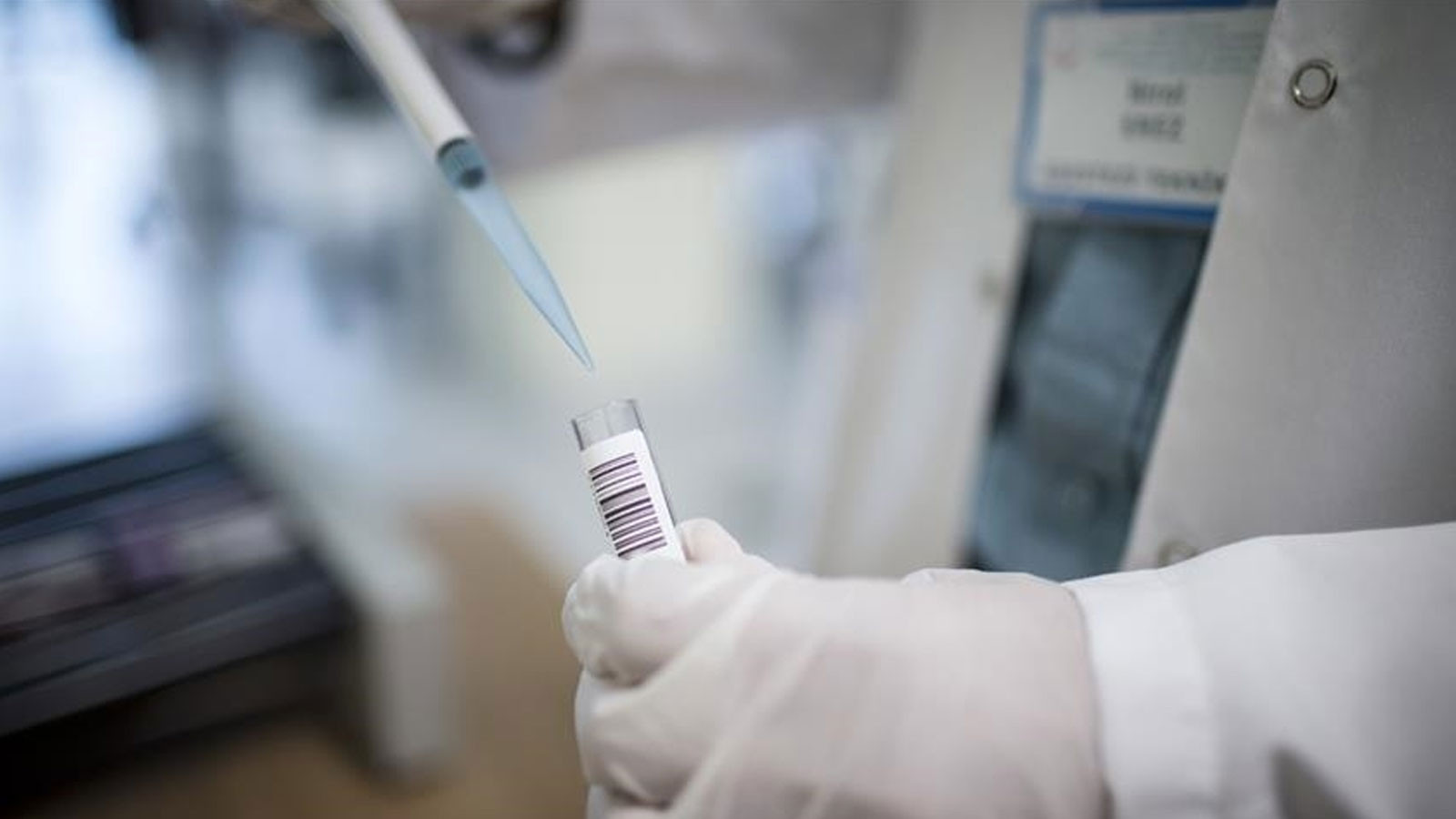 Dünyada en ölümcül bulaşıcı hastalık: Bu belirtilere dikkat! Dünyada en ölümcül bulaşıcı hastalık: Bu belirtilere dikkat!