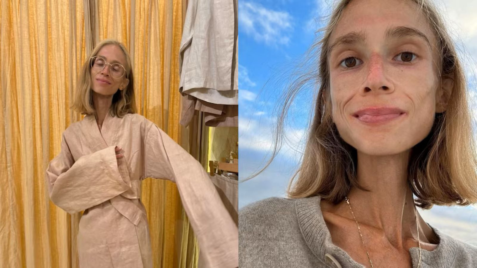 27 yaşındaki influencer’ın sonu oldu, 22 kiloya düşüp öldü