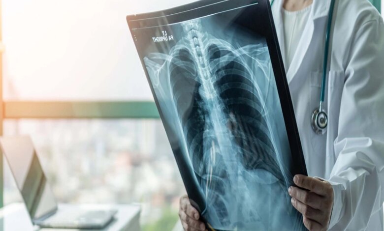 Prof. Dr. Şener’den süperenfeksiyon uyarısı